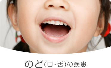 のど(口・舌)の疾患